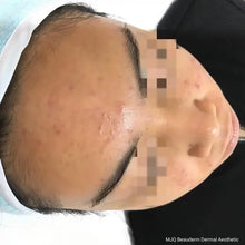 Load image into Gallery viewer, Dermatonics Clearskin® 50ml