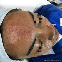 Load image into Gallery viewer, Dermatonics Clearskin® 50ml