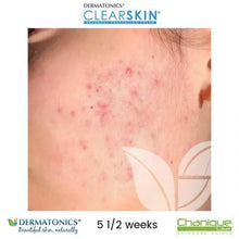 Load image into Gallery viewer, Dermatonics Clearskin® 50ml